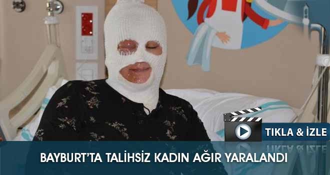 Bayburt’ta Talihsiz Kadın Ağır Yaralandı